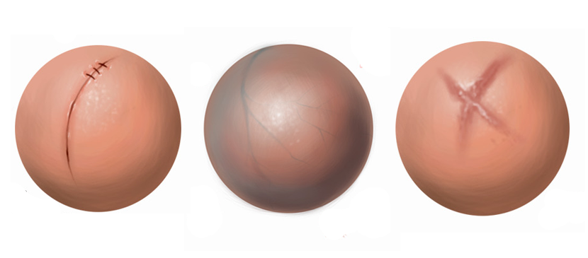 Making Different Human Skin Surfaces L